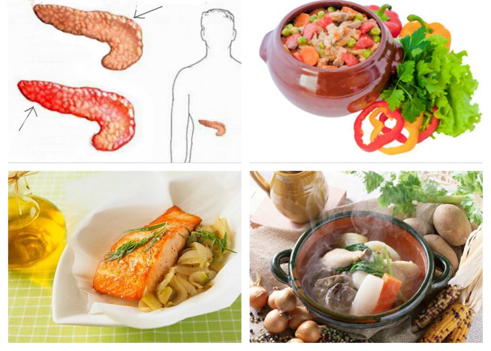 Dieta de pancreatitis